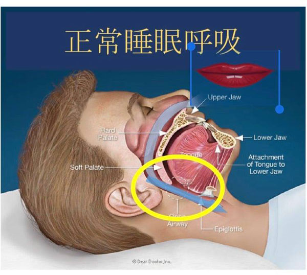 正常睡眠呼吸